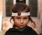 An Afghani Injured Girl