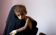181025 yemen famine mc 1048 1ddb6f0689f1ae0f0d8c904ae79e5233 226x145 - Khashoggi Versus 50,000 Slaughtered Yemeni Children