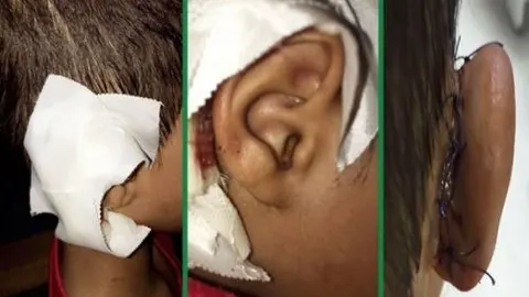 معلم سعودی گوش متعلمش را بُرید!