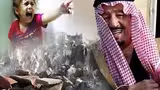 گزارشی شوک آور درباره اطفال یمن!