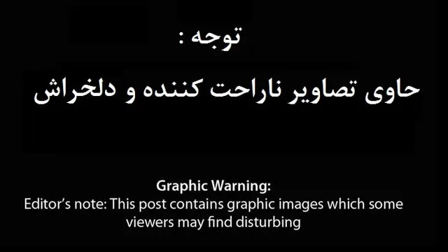 مریضی عجیبی که دختر زیبای روس را به اسکلت شبیه کرد! + تصاویر(18+)