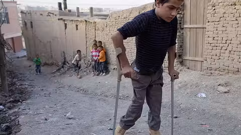 گزارش سازمان‌های بین‌المللی درباره شناسایی موارد جدید فلج اطفال در افغانستان