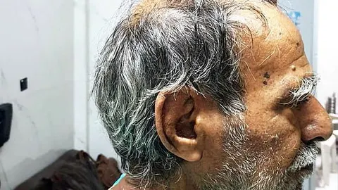 این مردی هندی روی سرش شاخ دارد! + تصاویر