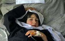 Afghan sick child