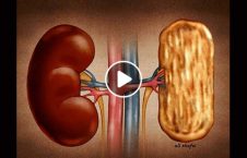 ویدیو/ فروش گرده‌ به دلیل فقر و بیکاری